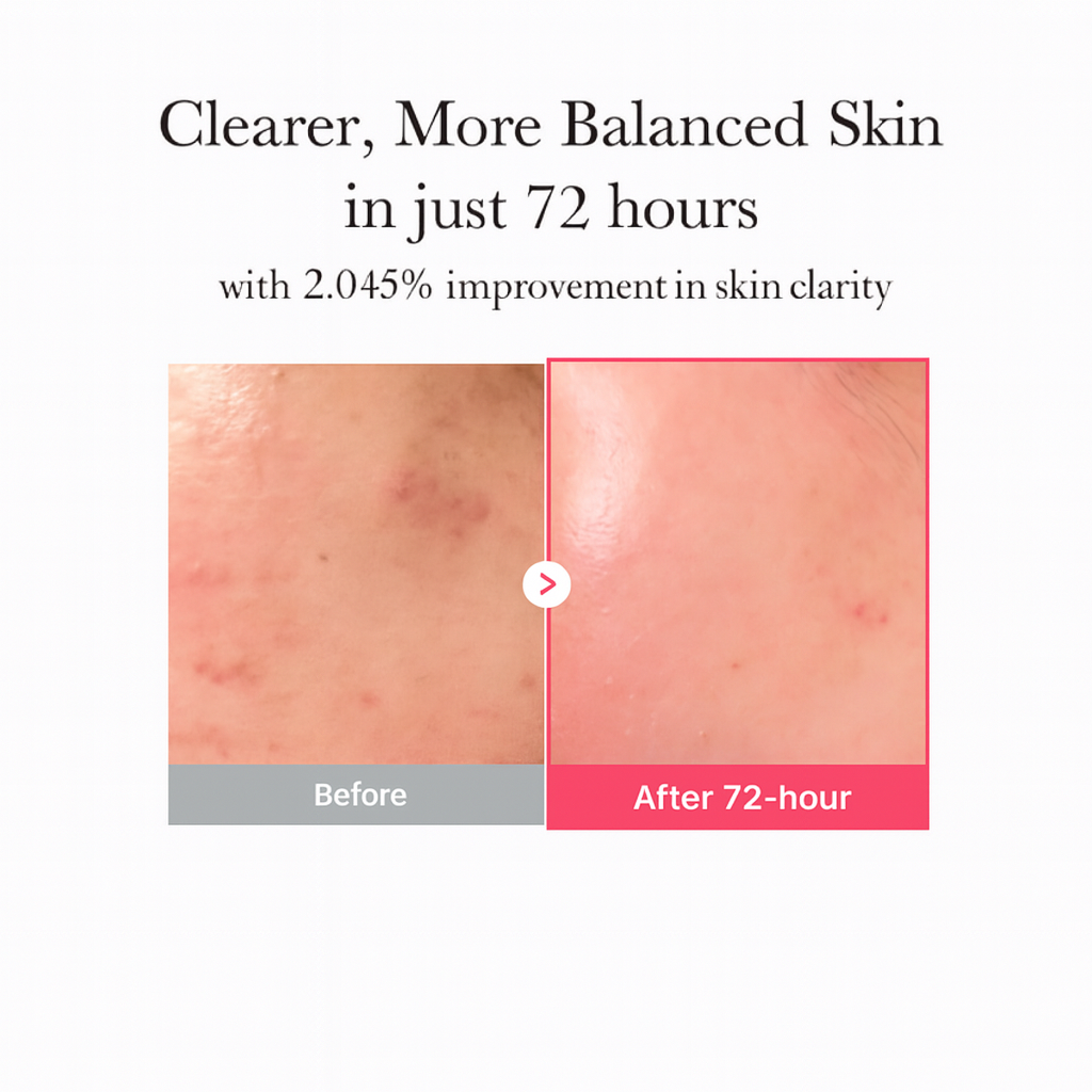 Pureve NIAWHIP TXA Serum
